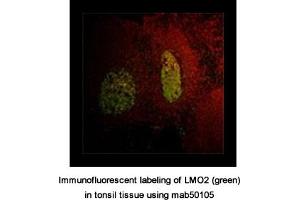 Image no. 1 for anti-LIM Domain Only 2 (Rhombotin-Like 1) (LMO2) antibody (ABIN363259) (LMO2 抗体)