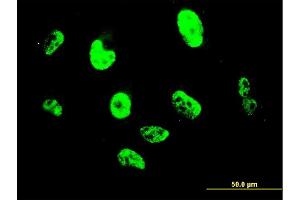 Immunofluorescence of monoclonal antibody to SNAI2 on HepG2 cell.