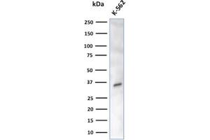 Western Blot Analysis of K-562 cell lysate using CA8 Mouse Monoclonal Antibody (CPTC-CA8-2). (CA8 抗体)