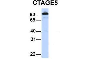 Host:  Rabbit  Target Name:  CTAGE5  Sample Type:  HepG2  Antibody Dilution:  1. (MIA2 抗体  (Middle Region))