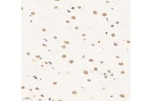 Immunohistochemistry (Paraffin-embedded Sections) (IHC (p)) image for anti-Suppressor of Ty 3 Homolog (SUPT3H) antibody (ABIN7075767)