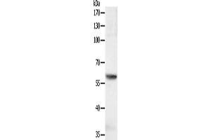 Gel: 10 % SDS-PAGE, Lysate: 40 μg, Lane: jurkat cells, Primary antibody: ABIN7131139(SOCS6 Antibody) at dilution 1/600, Secondary antibody: Goat anti rabbit IgG at 1/8000 dilution, Exposure time: 1 second (SOCS6 抗体)