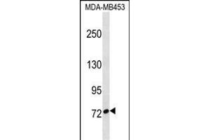 CUX1 Antibody (C-term) (ABIN1537517 and ABIN2850213) western blot analysis in MDA-M cell line lysates (35 μg/lane). (CUX1 抗体  (C-Term))