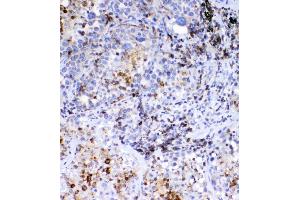 IHC analysis of Galectin 1 using anti-Galectin 1 antibody (ABIN3043804).
