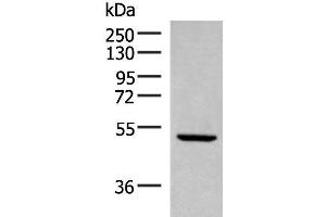 Western blot analysis of Rat heart tissue lysate using PSMD12 Polyclonal Antibody at dilution of 1:300 (PSMD12 抗体)