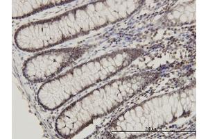 Immunoperoxidase of monoclonal antibody to RPL14 on formalin-fixed paraffin-embedded human colon. (RPL14 抗体  (AA 1-90))