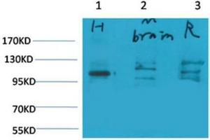 Western Blot (WB) analysis of 1) Human Brain Tissue, 2)Mouse Brain Tissue, 3) Rat Brain Tissue with Glutamate Receptor 1 Rabbit Polyclonal Antibody diluted at 1:2000. (Glutamate Receptor 1 抗体)
