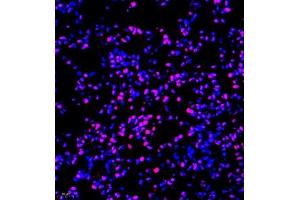 Immunofluorescence (Paraffin-embedded Sections) (IF (p)) image for anti-General Transcription Factor IIIC, Polypeptide 2, beta 110kDa (GTF3C2) antibody (ABIN7074038)