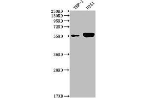 Western Blot Positive WB detected in: THP-1 whole cell lysate, U251 whole cell lysate All lanes: IRAK4 antibody at 1:2000 Secondary Goat polyclonal to rabbit IgG at 1/50000 dilution Predicted band size: 52, 38 kDa Observed band size: 55 kDa (Recombinant IRAK4 抗体)