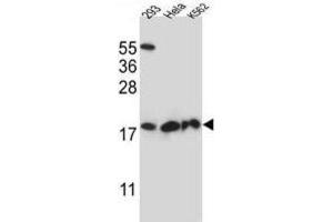 Western Blotting (WB) image for anti-Dihydrofolate Reductase-Like 1 (DHFRL1) antibody (ABIN2997304) (DHFRL1 抗体)