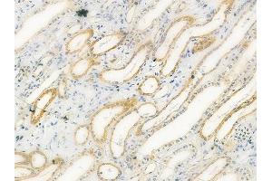ABIN6258955 and ABIN6275155 at 1/100 staining human normal kidney tissue by IHC-P. (GSTT1 抗体  (N-Term))