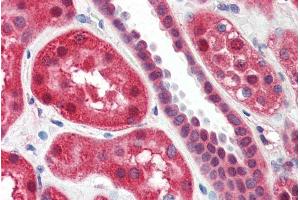 ABIN334342 (2µg/ml) staining of paraffin embedded Human Kidney. (ALOX15 抗体  (Internal Region))