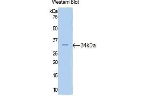 Western blot analysis of the recombinant protein. (Fascin 2 抗体  (AA 8-278))