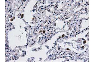 Immunohistochemical staining of paraffin-embedded Human lung tissue using anti-CCM2 mouse monoclonal antibody. (CCM2 抗体)
