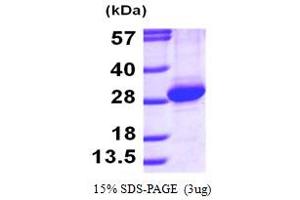 SDS-PAGE (SDS) image for RAB11A, Member RAS Oncogene Family (RAB11A) (AA 1-213) protein (His tag) (ABIN666996)