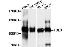 Western blot analysis of extracts of various cells, using TBL3 antibody. (TBL3 抗体)