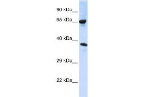 WB Suggested Anti-C6orf134 Antibody Titration:  0. (Chromosome 6 Open Reading Frame 134 (C6orf134) (Middle Region) 抗体)