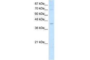 WB Suggested Anti-NXF5 Antibody Titration:  2. (NXF5 抗体  (Middle Region))