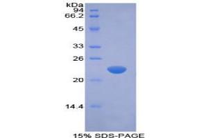 SDS-PAGE analysis of Rabbit Interferon beta Protein.