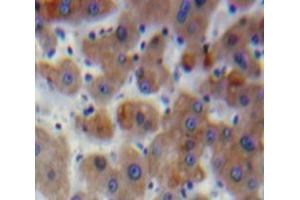 Used in DAB staining on fromalin fixed paraffin-embedded Liver tissue (SERPINB2 抗体  (AA 68-313))
