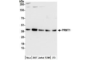 Western Blotting (WB) image for anti-Protein Arginine Methyltransferase 1 (PRMT1) (AA 1-50) antibody (ABIN7453933) (PRMT1 抗体  (AA 1-50))