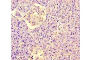 Immunohistochemistry of paraffin-embedded human pancreatic tissue using ABIN7158094 at dilution of 1:100 (PPIL5 抗体  (AA 18-159))