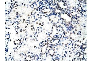 Nucleolin antibody was used for immunohistochemistry at a concentration of 4-8 ug/ml to stain Epithelial cells of renal tubule (arrows) in Human Kidney. (Nucleolin 抗体  (C-Term))