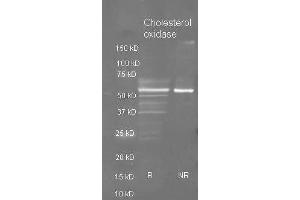 Goat anti Cholesterol oxidase antibody  was used to detect purified cholesterol oxidase under reducing (R) and non-reducing (NR) conditions. (Cholesterol Oxidase 抗体  (HRP))