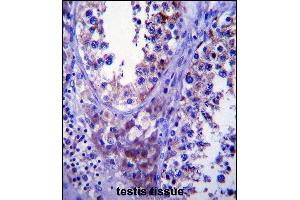 Immunohistochemistry (Paraffin-embedded Sections) (IHC (p)) image for anti-Stromal Cell Derived Factor 2-Like 1 (SDF2L1) (AA 160-189), (C-Term) antibody (ABIN657402)