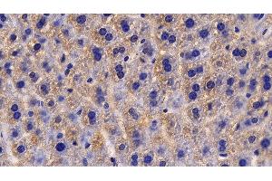 Immunohistochemistry (IHC) image for anti-Interleukin 13 Receptor, alpha 2 (IL13RA2) (AA 228-338) antibody (ABIN7433879)