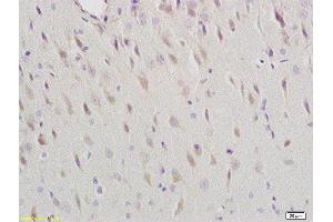 Formalin-fixed and paraffin embedded rat brain labeled with Anti-Dopamine Receptor D1 Polyclonal Antibody, Unconjugated  at 1:200 followed by conjugation to the secondary antibody and DAB staining
