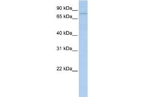 WB Suggested Anti-PYGB Antibody Titration:  0. (PYGB 抗体  (N-Term))
