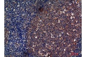 Immunohistochemistry (IHC) analysis of paraffin-embedded Human Tonsils, antibody was diluted at 1:100. (CD13 抗体  (Internal Region))
