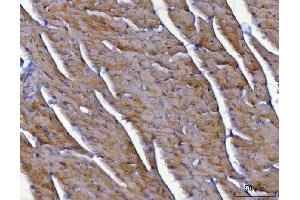 IHC analysis of NDUFS8 using anti-NDUFS8 antibody (ABIN7599086).