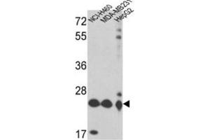 Western Blotting (WB) image for anti-Peroxiredoxin 3 (PRDX3) antibody (ABIN3001722) (Peroxiredoxin 3 抗体)
