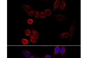 Immunofluorescence (IF) image for anti-Cytochrome P450, Family 2, Subfamily A, Polypeptide 6 (CYP2A6) antibody (ABIN7258314)