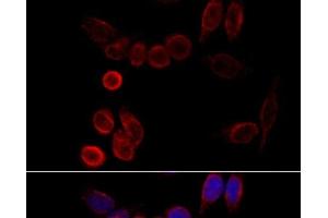 Immunofluorescence analysis of HeLa cells using CYP2A6 Polyclonal Antibody at dilution of 1:100 (40x lens). (CYP2A6 抗体)