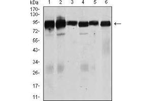 Western blot analysis using TGFBR3 mouse mAb against Jurkat (1), HeLa (2), MCF-7 (3), F9 (4), SK-N-SH (5), and NIH3T3 (6) cell lysate. (TGFBR3 抗体  (AA 147-328))