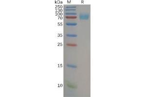 Human IL7RA Protein, hFc Tag on SDS-PAGE under reducing condition.
