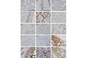 Immunohistochemical staining of various tissues with hematoxylin and HSD3B1 antibody under high magnification. (HSD3B1 抗体  (AA 1-373))