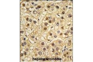 Formalin-fixed and paraffin-embedded human testis tissue reacted with YWHAZ Antibody (ABIN392783 and ABIN2842221) , which was peroxidase-conjugated to the secondary antibody, followed by DAB staining. (14-3-3 zeta 抗体  (AA 211-239))