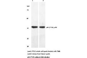 Western blot (WB) analyzes of p38 antibody (MAPK14 抗体)