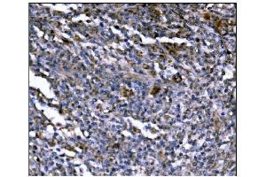 IHC analysis of ERAP2 using anti-ERAP2 antibody (ABIN7599949). (ERAP2 抗体  (AA 13-960))