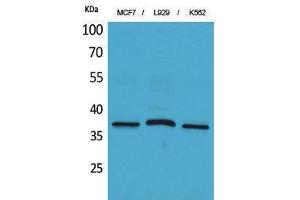 Western Blotting (WB) image for anti-CD79b Molecule, Immunoglobulin-Associated beta (CD79B) (Internal Region) antibody (ABIN3178286) (CD79b 抗体  (Internal Region))