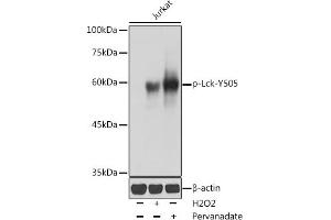 Western blot analysis of extracts of Jurkat cells, using Phospho-Lck-Y505 antibody (ABIN3020027, ABIN3020028, ABIN3020029 and ABIN6225502) at 1:1000 dilution. (LCK 抗体  (pTyr505))