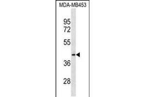 Western blot analysis in MDA-MB453 cell line lysates (35ug/lane). (MRPL46 抗体  (C-Term))