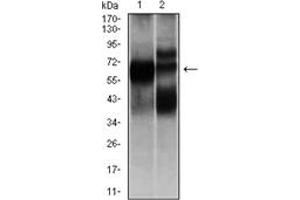 Western Blotting (WB) image for anti-Hexosaminidase A (HEXA) antibody (ABIN1105521)
