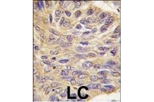 Immunohistochemistry (Paraffin-embedded Sections) (IHC (p)) image for anti-Protein tyrosine Phosphatase, Non-Receptor Type 9 (PTPN9) (AA 477-505), (C-Term) antibody (ABIN392827)