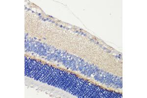 Immunohistochemistry of paraffin-embedded mouse retina using  antibody (ABIN6129704, ABIN6136903, ABIN6136905 and ABIN6216979) at dilution of 1:200 (40x lens). (Anoctamin 2 抗体  (AA 1-200))