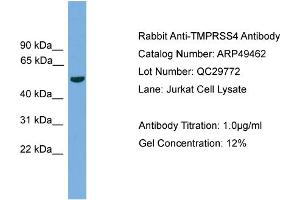 WB Suggested Anti-TMPRSS4  Antibody Titration: 0. (TMPRSS4 抗体  (N-Term))